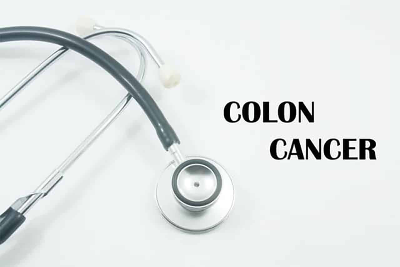 Colon Cancer