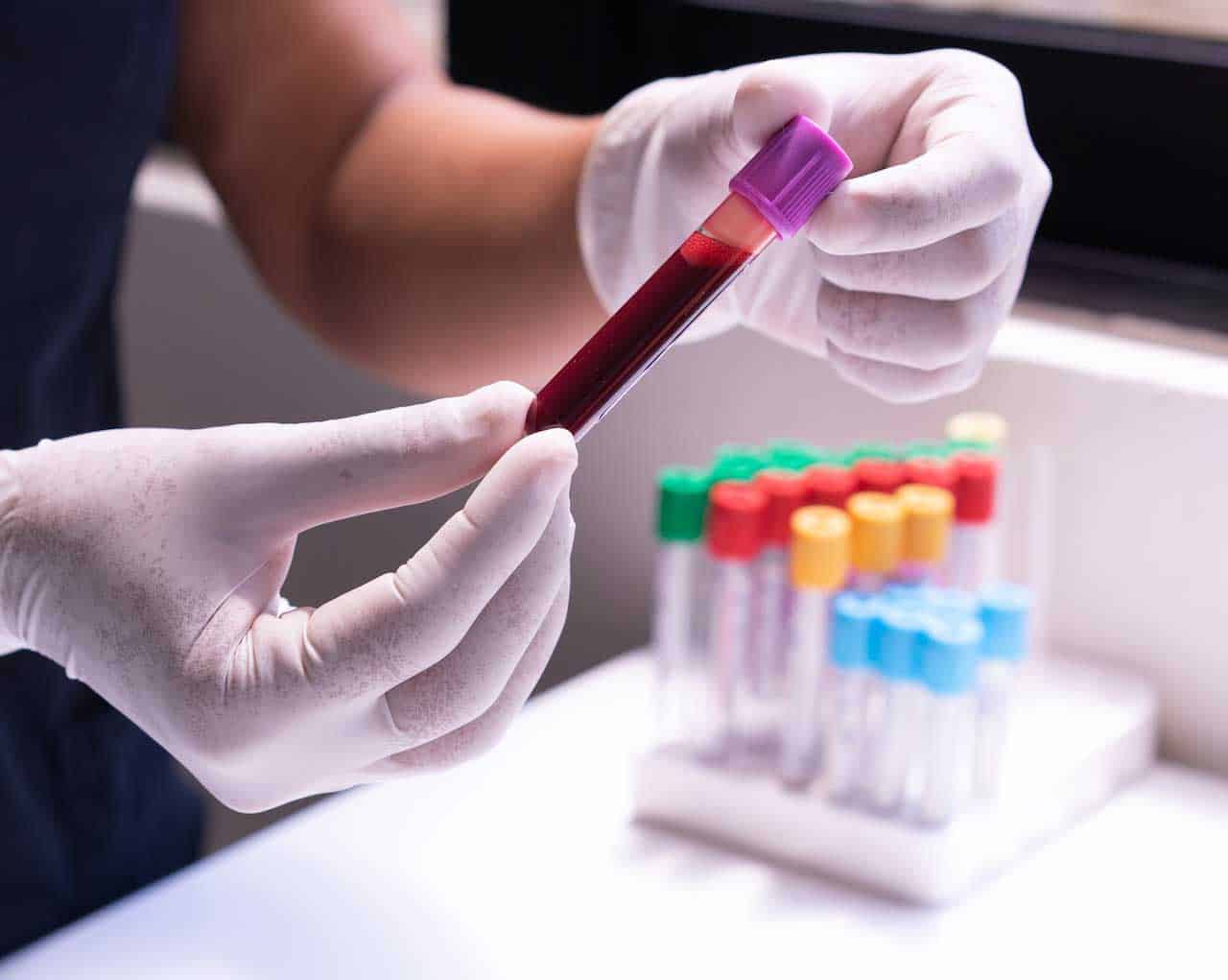 5 Things You Should Know About Your Blood